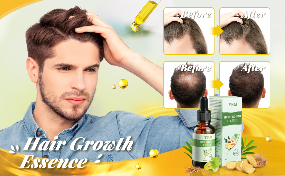  Herbal Ginger Hair Growth Essence, Hair Loss Prevention Treatment,  Stimulate Hair Follicles, Strengthens Hair Roots – Luckyfine