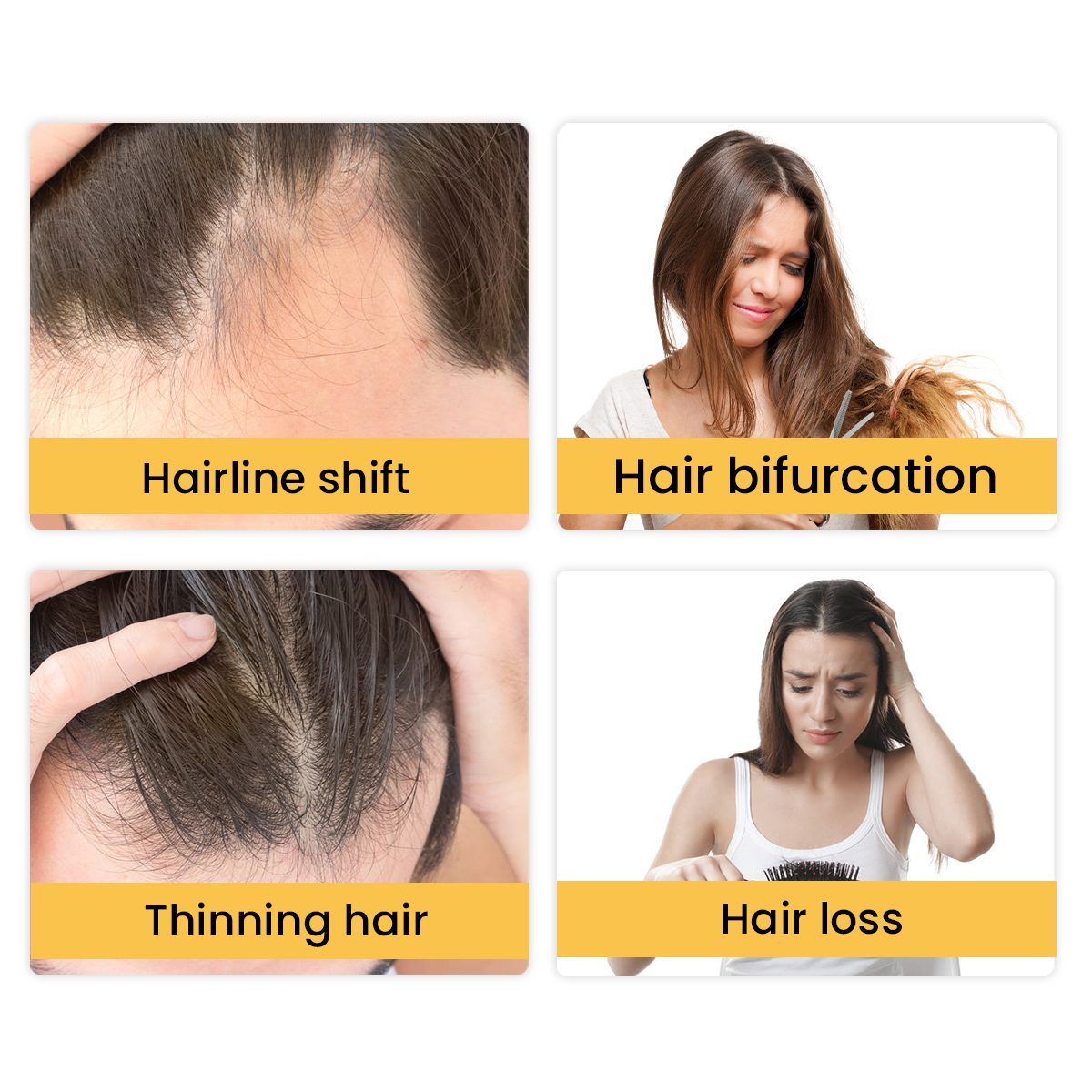  Herbal Ginger Hair Growth Essence, Hair Loss Prevention Treatment,  Stimulate Hair Follicles, Strengthens Hair Roots – Luckyfine